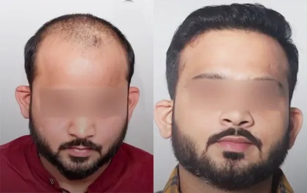 Sapphire – Precision Dense Packing