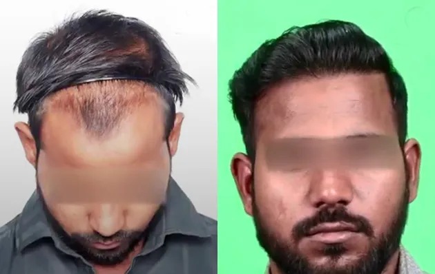 Beard/Moustache/Eyebrow Options